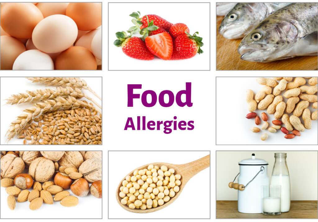 Food-Allergies-1024x717-1